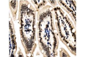 IHC analysis of HP1 alpha/CBX5 using anti-HP1 alpha/CBX5 antibody (ABIN7599058). (CBX5 anticorps  (AA 1-191))