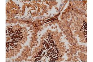 ABIN6267363 at 1/200 staining Mouse testis tissue sections by IHC-P. (MAPT anticorps  (pSer262))