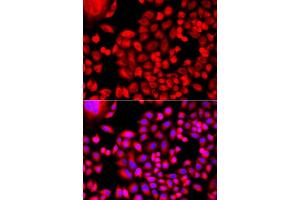 Immunofluorescence analysis of A549 cells using MTHFD1L antibody. (MTHFD1L anticorps  (AA 759-978))