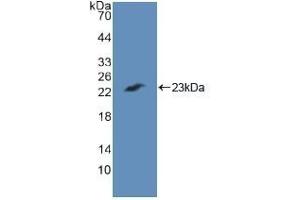 Detection of Recombinant CASP7, Human using Polyclonal Antibody to Caspase 7 (CASP7) (Caspase 7 anticorps  (AA 24-198))