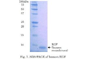 SDS-PAGE (SDS) image for Epidermal Growth Factor (EGF) (Active) protein (ABIN2452188) (EGF Protéine)