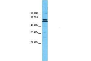 Host:  Rabbit  Target Name:  MLLT3  Sample Type:  721_B Cell lysates  Antibody Dilution:  1.