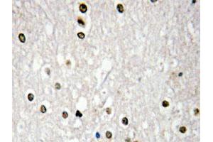 Immunohistochemical analysis of paraffin-embedded human brain tissue using TP73 polyclonal antibody . (Tumor Protein p73 anticorps)