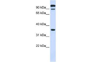 WB Suggested Anti-PTPRE Antibody Titration:  0. (PTPRE anticorps  (Middle Region))