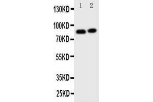 Western Blotting (WB) image for anti-Gelsolin (GSN) (AA 763-775), (C-Term) antibody (ABIN3043978) (Gelsolin anticorps  (C-Term))
