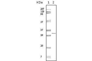 Western blot analysis using HPTR mouse mAb against truncated HPRT recombinant protein. (HPRT1 anticorps)