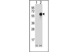 Western blot analysis of LZP (arrow) using LZP Antibody .