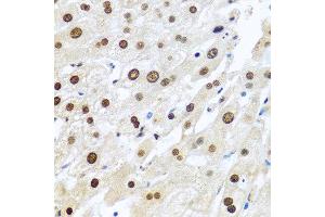 Immunohistochemistry of paraffin-embedded human liver using METTL3 antibody at dilution of 1:100 (40x lens). (METTL3 anticorps)