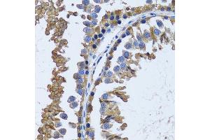 Immunohistochemistry of paraffin-embedded mouse testis using IMPA1 antibody. (IMPA1 anticorps  (AA 1-277))