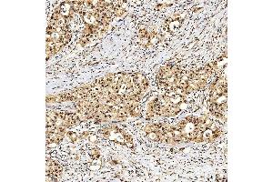 IHC analysis of SNF2H/SMARCA5 using anti-SNF2H/SMARCA5 antibody (ABIN7602001).