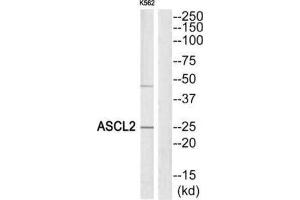 Western Blotting (WB) image for anti-Achaete-Scute Complex Homolog 2 (ASCL2) (Internal Region) antibody (ABIN1849922) (ASCL2 anticorps  (Internal Region))