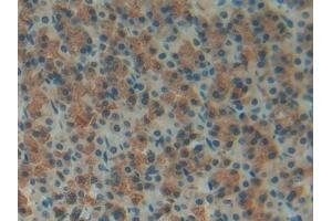 Detection of FOSL1 in Rat Stomach Tissue using Polyclonal Antibody to FOS Like Antigen 1 (FOSL1)