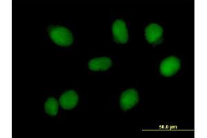 Immunofluorescence of purified MaxPab antibody to RMI1 on HeLa cell. (RMI1 anticorps  (AA 1-470))