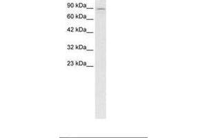 Image no. 2 for anti-Kinesin Family Member 5B (KIF5B) (AA 694-743) antibody (ABIN6736277) (KIF5B anticorps  (AA 694-743))