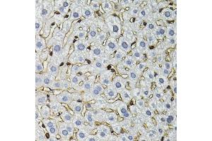 Immunohistochemistry of paraffin-embedded mouse liver using ANXA2 antibody. (Annexin A2 anticorps)