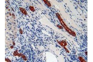 IHC-P analysis of Human Liver Tissue, with DAB staining. (Cytokeratin 7 anticorps  (AA 91-394))