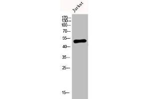 Western Blot analysis of Jurkat cells using DR4 Polyclonal Antibody