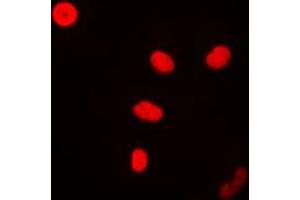 Immunofluorescent analysis of FEN1 staining in MCF7 cells. (FEN1 anticorps  (Center))