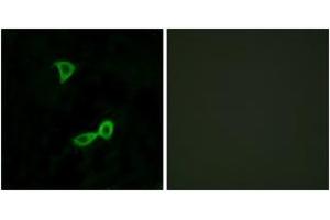 Immunofluorescence analysis of LOVO cells, using GRM2 Antibody. (GRM2 anticorps  (AA 241-290))