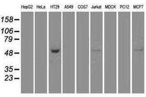Image no. 2 for anti-serine threonine Kinase 39 (STK39) antibody (ABIN1501212) (STK39 anticorps)