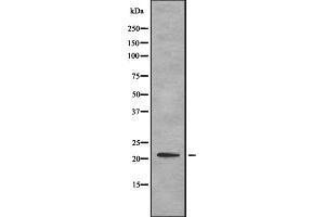 Western blot analysis of ITBP1 expression in HEK293 cells ,The lane on the left is treated with the antigen-specific peptide. (ITGB1BP1 anticorps  (Internal Region))
