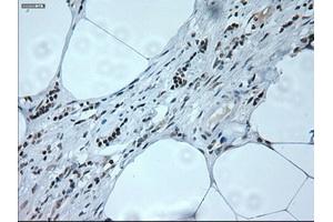 Immunohistochemical staining of paraffin-embedded liver tissue using anti-NEUROG1mouse monoclonal antibody. (Neurogenin 1 anticorps)