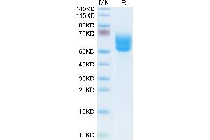 DKK3 (AA 23-350) protein (His-Avi Tag,Biotin)