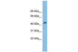PNPLA1 antibody used at 1 ug/ml to detect target protein. (PNPLA1 anticorps  (Middle Region))