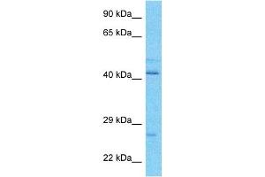 Host:  Rabbit  Target Name:  VATE1  Sample Type:  OVCAR-3 Whole Cell lysates  Antibody Dilution:  1. (ATP6V1E1 anticorps  (N-Term))