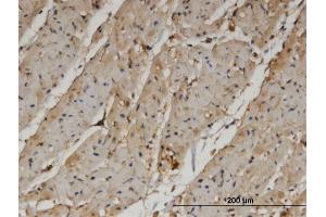 Immunoperoxidase of monoclonal antibody to PANK4 on formalin-fixed paraffin-embedded human heart.