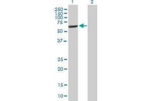 Western Blot analysis of IMPDH2 expression in transfected 293T cell line by IMPDH2 MaxPab polyclonal antibody.