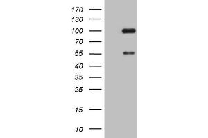 Western Blotting (WB) image for anti-ADAM Metallopeptidase with Thrombospondin Type 1 Motif, 4 (ADAMTS4) (AA 296-577) antibody (ABIN2715720) (ADAMTS4 anticorps  (AA 296-577))