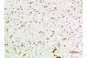 Immunohistochemical analysis of paraffin-embedded human-brain, antibody was diluted at 1:200