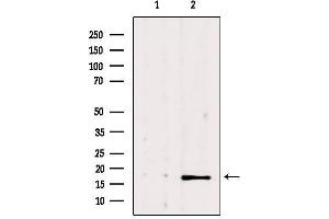 Western blot analysis of extracts from 293, using NME1 Antibody. (NME1 anticorps  (C-Term))