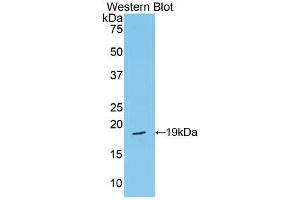 Western blot analysis of the recombinant protein. (Periostin anticorps  (AA 659-810))