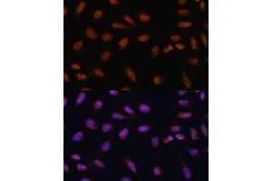 Immunofluorescence analysis of U-2 OS cells using SARNP antibody (ABIN6130106, ABIN6147381, ABIN6147382 and ABIN6217793) at dilution of 1:100. (SARNP anticorps  (AA 1-210))