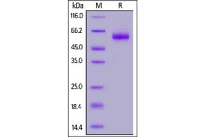 SARS-CoV-2 Nucleocapsid protein, His Tag (B.