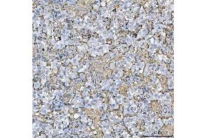 IHC analysis of HLA-DRA using anti-HLA-DRA antibody (ABIN7600948). (HLA-DRA anticorps  (AA 26-254))