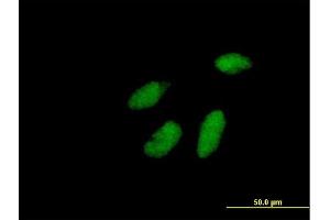 Immunofluorescence of purified MaxPab antibody to RAD1 on HeLa cell.