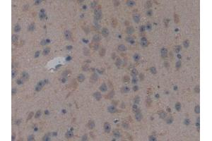 Detection of NPPB in Mouse Cerebrum Tissue using Polyclonal Antibody to Natriuretic Peptide Precursor B (NPPB)