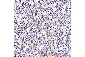 Immunohistochemistry of paraffin-embedded mouse fetal liver using CMIP Rabbit pAb (ABIN7265970) at dilution of 1:50 (40x lens). (CMIP anticorps)