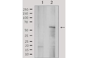 Western blot analysis of extracts from rat brain, using YTHDF1 Antibody. (YTHDF1 anticorps  (N-Term))