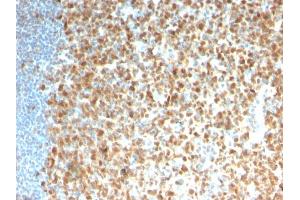 Formalin-fixed, paraffin-embedded human Tonsil stained with MCM7 Recombinant Mouse Monoclonal Antibody (rMCM7/1468). (Recombinant MCM7 anticorps  (AA 195-319))