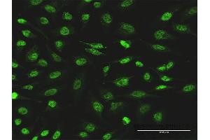Immunofluorescence of monoclonal antibody to PIK3CB on HeLa cell.