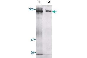 Western Blotting with Mug1 polyclonal antibody . (Murinoglobulin 1 anticorps)