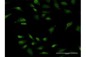 Immunofluorescence of monoclonal antibody to PRKRIP1 on HeLa cell. (PRKRIP1 anticorps  (AA 1-184))