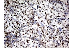 anti-Nibrin (NBN) (AA 461-754) antibody