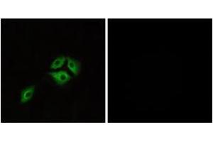 Immunofluorescence analysis of A549 cells, using NMBR Antibody. (NMBR anticorps  (AA 221-270))