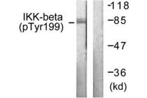 Western blot analysis of extracts from HeLa cells treated with TNF-a 20ng/ml+Calyculin A 50nM 5', using IKK-beta (Phospho-Tyr199) Antibody. (IKBKB anticorps  (pTyr199))