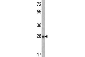 Western blot analysis of IGFBP6 antibody and CEM lysate.